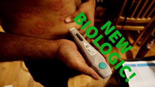 MY NEW BIOLOGIC HAS ARRIVED! Psoriasis treatment! skyrizi