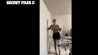 Clip 355 Modeling with broken knee