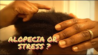 Real Talk: Is This CCC Alopecia? 4C Hair Loss