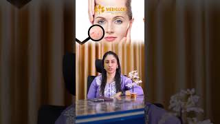 Face Glow ചെയ്യും നിമിഷങ്ങൾക്കുള്ളിൽ✨ | Carbon lazer peel | Mediglow