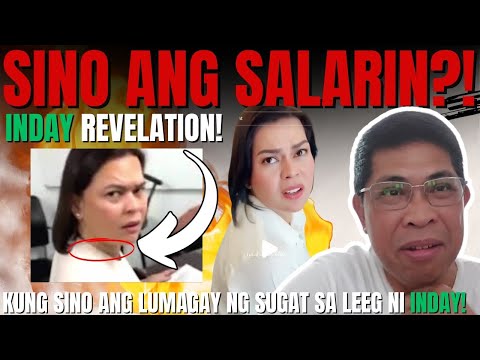 "SILANG LAHAT" INDAY MAY REBELASYON SA NANGYARI SA LEEG NYA