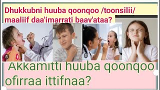 Dhukkuba huuba qoonqoo(tonsiliis)