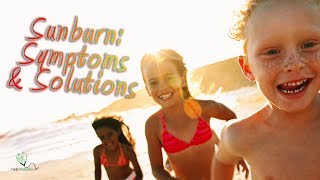 Sunburn in children: Symptoms and Treatments