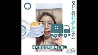 【牛皮癣 | 湿疹分享】#20 The Perfect Derma —— 婆婆的皮肤问题