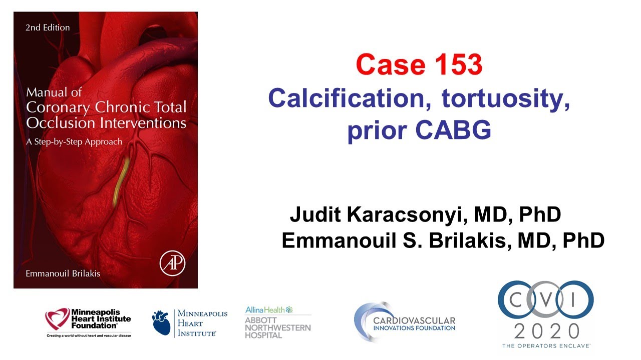 Case 153: Manual Of CTO PCI - Tortuous, Calcified RCA CTO In A Prior ...