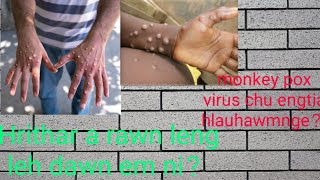 Hrileng thar awm tihna mi.A lo lan chhuah dan leh inven dan tur.monkey pox virus