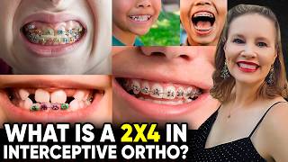 What is a 2x4 in Interceptive Ortho? Phase 1 Braces Explained