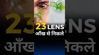 23 lenses Stuck inside Eye