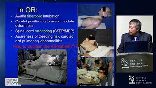 Cervico-thoracic Junction PSO for the Correction of Post-Traumatic Chin-On-Chest Kyphotic Deformity