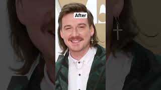 Singers before and after fame ✨ 💖 || Morgan Wallen || #morganwallen #countrymusic #shorts #youproof
