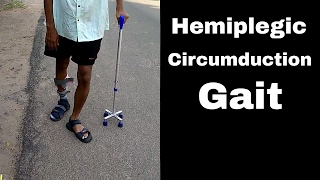 How does a Hemiplegic Walks in Circumduction Gait