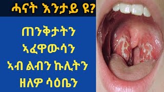 ሓናት እንታይ እዩ? ጠንቅታትን , ምልክታትን ብኸመይ  ንፍውሶ? ብኸመይ እዩ ሓናት ድኻም ልብን ኩሊትን ከስዕብ ዝኽእል?        Tonsillitis