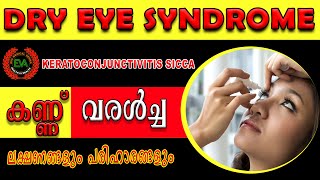 DRY EYE SYNDROME | വരണ്ട കണ്ണുകൾ | What is Dry Eyes and Watering Of Eye | Malayalam Health Tips