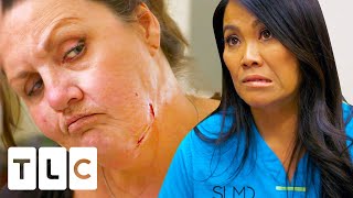 "I Don't Have OCD": Woman In Denial Of Her Skin Condition | Dr. Pimple Popper