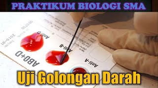 Praktikum Biologi : Uji Golongan Darah