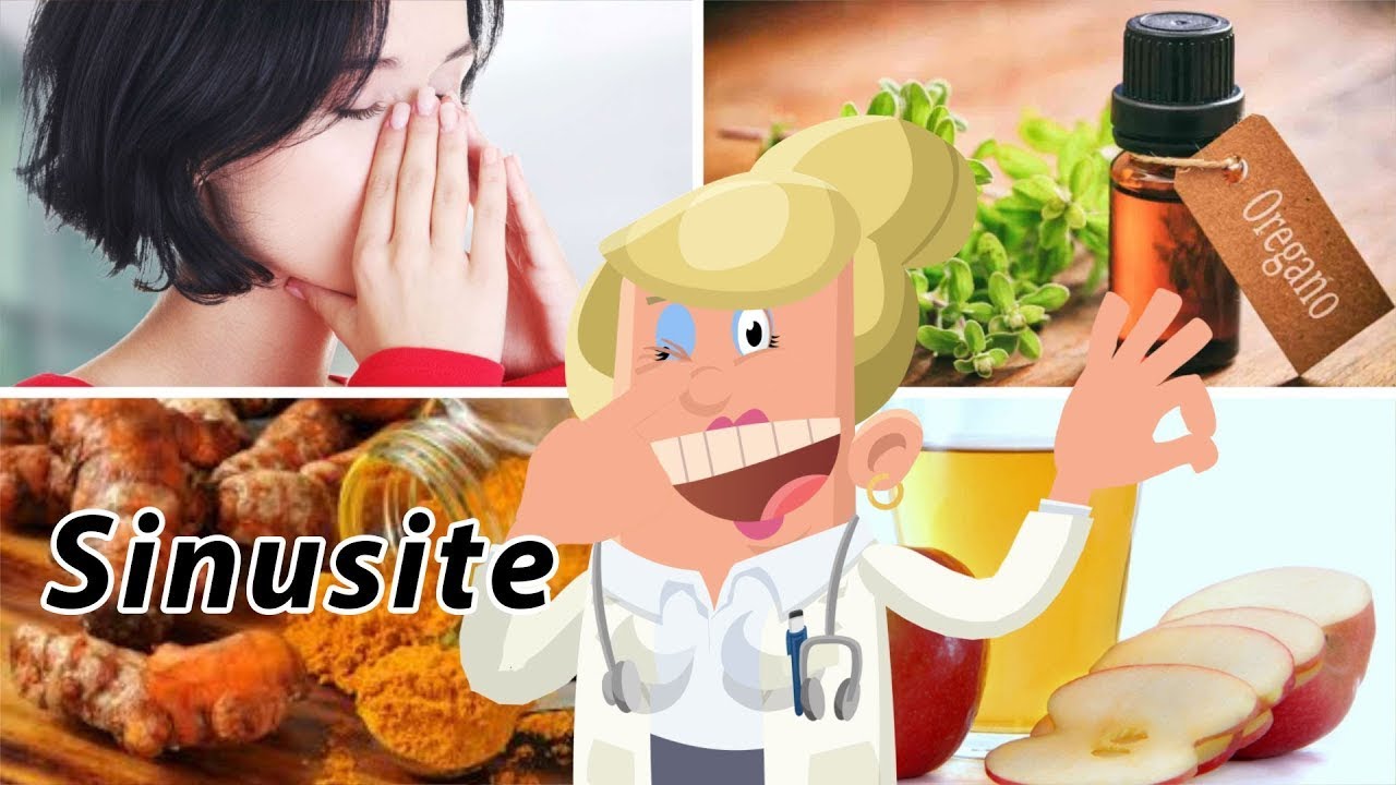 Sinusitis - Meilleurs Remedes Maison Naturels Pour La Sinusite - YouTube