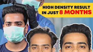 Hair transplant in Mumbai | Best Results & Cost of Hair Transplant in Mumbai