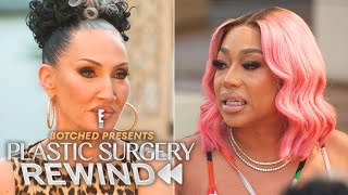 Jessica Dime Reveals BBL & Filler Complications | Plastic Surgery Rewind | E