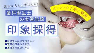 【印象採得が上手くなるコツ】🦷歯科衛生士、歯学部生、研修医向け🦷