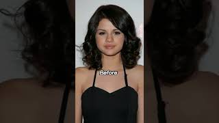 Selena Gomez: Before and After - A Look at Her Transformation