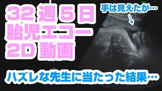 胎児エコー動画32週5日め baby echo 32w5d