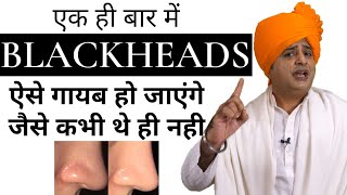 Blackheads जड़ से खत्म करने के लिए Get Rid of Blackheads || Sanyasi Ayurveda ||