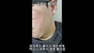 다이어트하면서 겪은 피부 변화 #헬스 #다이어트 #운동 #피부관리