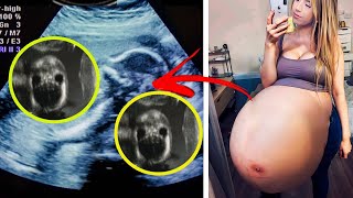 Surrogate Mother's Belly Keeps Growing! Doctor Discovers Something on Ultrasound and FAINTS!