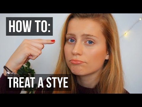How to Treat a Stye in Your Eye QUICKLY | Ellesse How to Treat a Stye in Your Eye QUICKLY | Ellesse