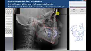 V-Ceph Training Video
