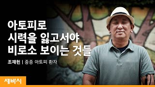 (Jp) 보통사람은 무엇이든 할 수 있는 사람입니다 | 조재헌 중증 아토피 환자 | 아토피 치유 편견  | 세바시 1237회