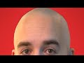 I Went Bald to Save The Children