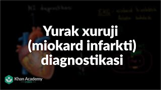 Yurak xuruji (miokard infarkti) diagnostikasi | Tibbiyot