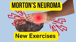 Morton's neuroma: The First Exercises To Start With!