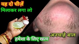 stop Shaving👉ये मामूली सी चीज से दाढ़ी,मूछ बिलकुल गायब || facial hair removal at home || Tapasya's