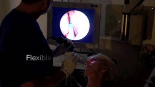 Balloon Sinuplasty In-Office Procedure with Dr Paul Lapco