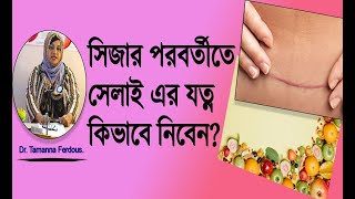 সিজার পরবর্তীতে সেলাই এর যত্ন কিভাবে নিবেন?/proper care of c section.