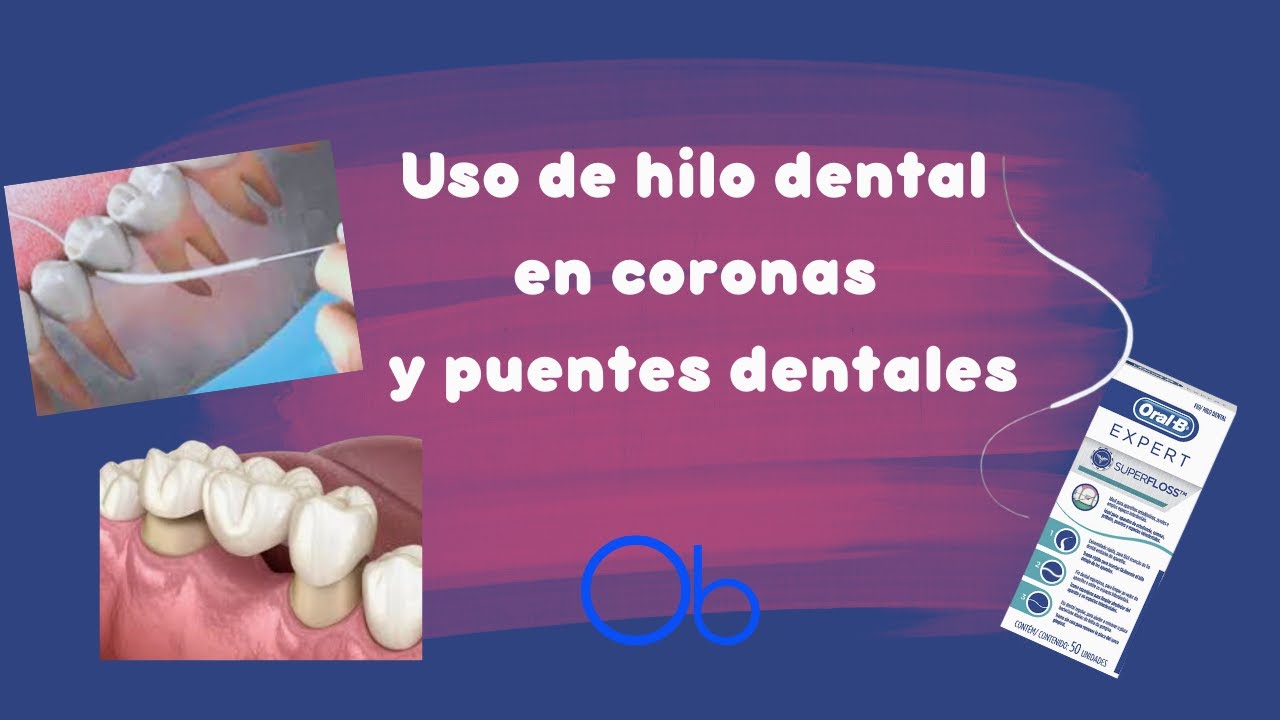 Aprende A Usar El Hilo Dental Para Coronas Y Puentes 🦷 Oral-B ...