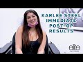 Karlee Steel Immediate Post-Op Results | Lipo & J-Plasma by Dr. Salama