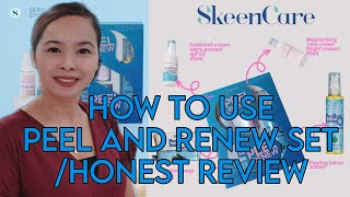 HOW TO USE SKEENCARE PEEL AND RENEW SET/ HONEST REVIEW