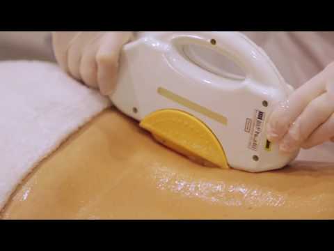 Subiaco Waxing SHR hair removal for Men Subiaco Waxing SHR hair removal for Men