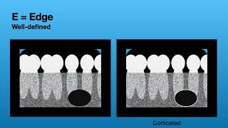 Describing Radiographic Lesions using my LESION(S) acronym