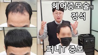 헤어증모술의 정석 정품 퍼니t 증모 궁금하셨죠? 바로 이렇게 합니다.