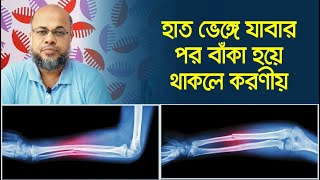 হাত ভেঙ্গে যাবার পর বাঁকা হয়ে থাকলে করণীয় | Rehabilitation After Accident Or After Fracture