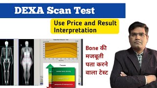 What is DEXA Scan Test? Use Procedure Result Interpretation and Price (Explained in Hindi)