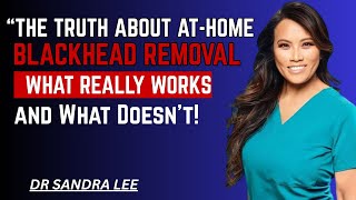 “The Truth About At-Home Blackhead Removal — What Really Works (and What Doesn’t!)”[DR SANDRA LEE]