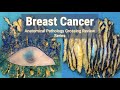 Breast Cancer | Anatomical Pathology Grossing Review Series