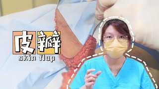 全程高能！皮瓣移植——整形外科金字塔上的明珠~||skin flap