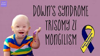 DOWN'S SYNDROME | TRISOMY 21 | MONGOLISM |GENETICS | Malayalam | Bio Ocean by Sheethal Maria