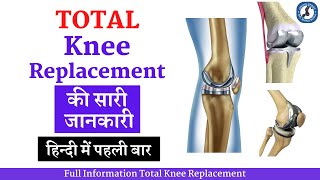Total Knee Replacement की सारी जानकारी पहली बार हिन्दी में , #TKR Complete Information in Hindi